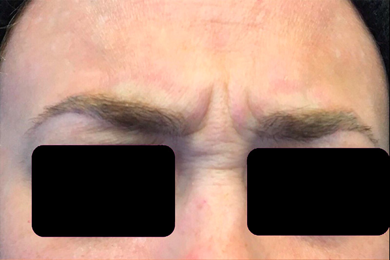 Injectables And Fillers 01