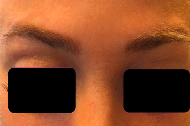 Injectables And Fillers 52