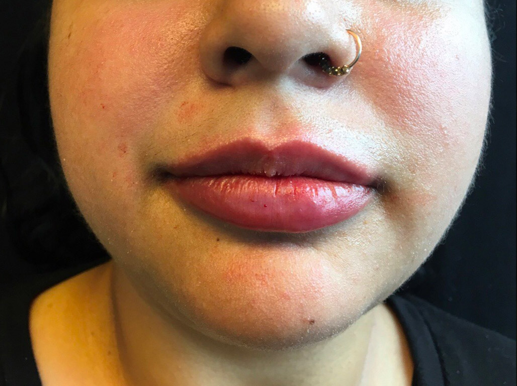 Injectables And Fillers 57