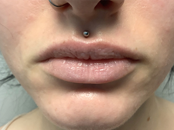 Injectables And Fillers 01