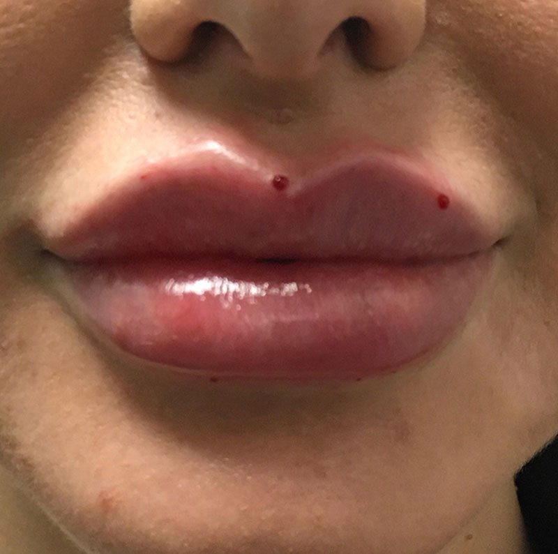 Injectables And Fillers 66