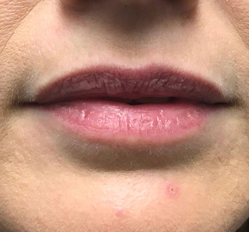 Injectables And Fillers 01