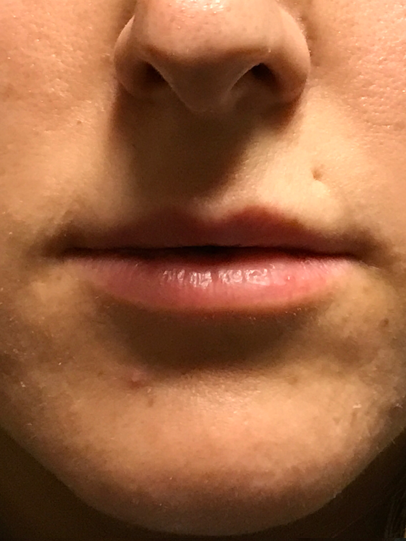 Injectables And Fillers 01