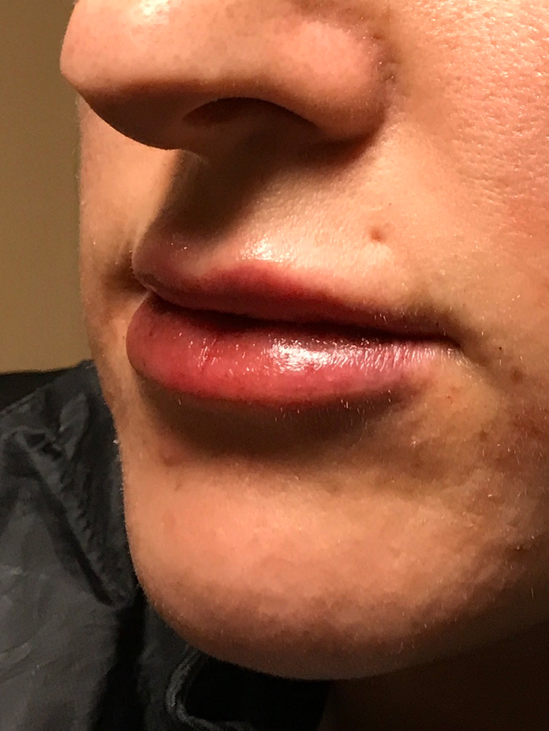 Injectables And Fillers 03