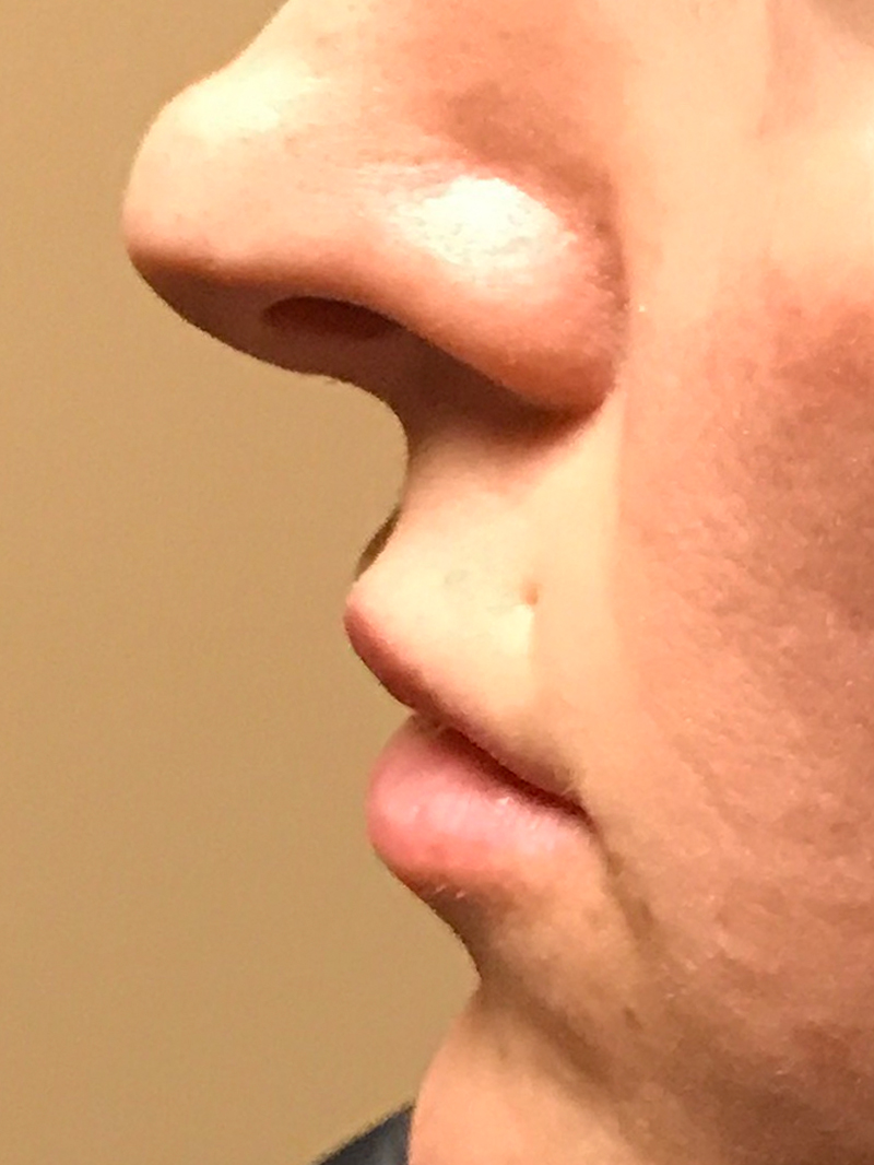 Injectables And Fillers 05