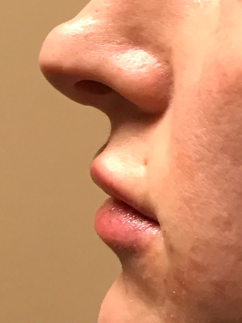 Injectables And Fillers 05