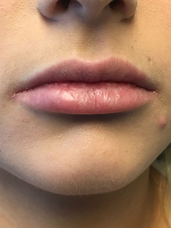 Injectables And Fillers 01