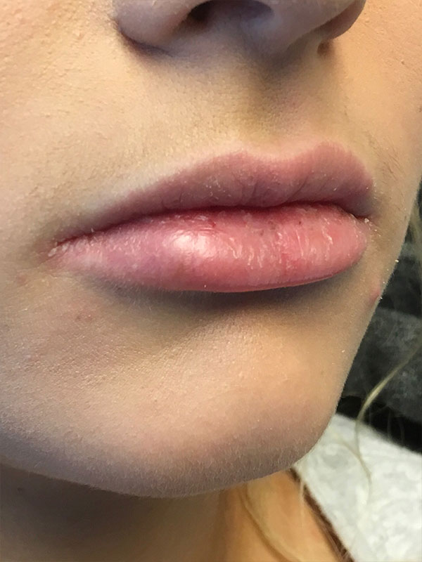 Injectables And Fillers 03