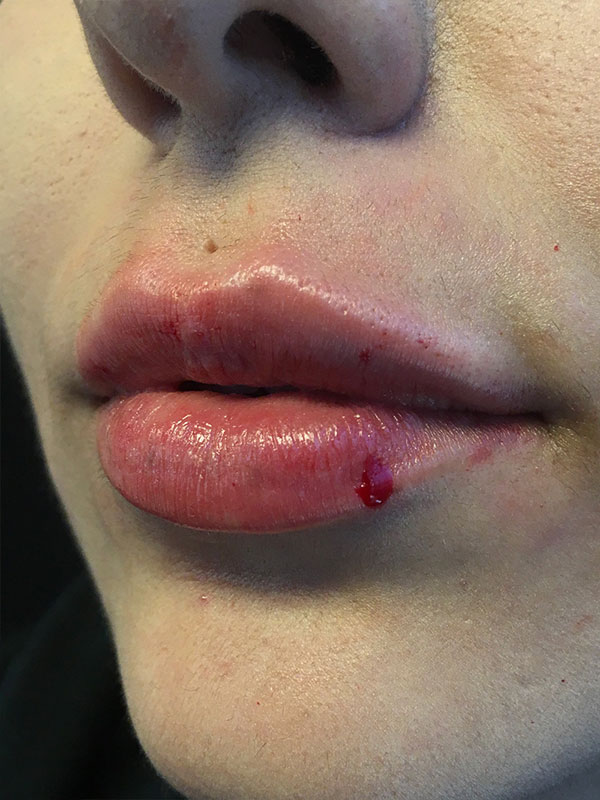 Injectables And Fillers 72