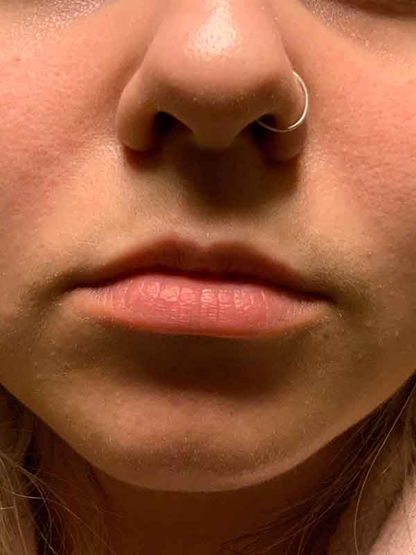 Injectables And Fillers 01