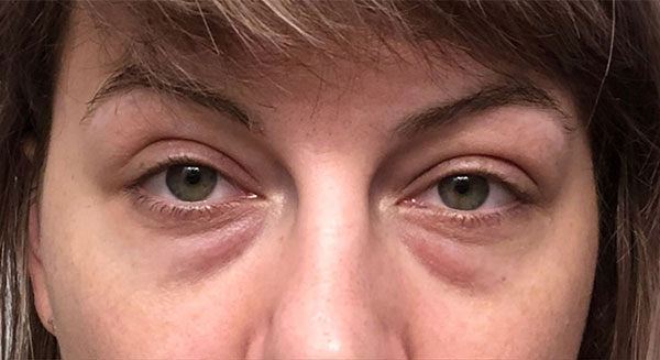 Injectables And Fillers 01