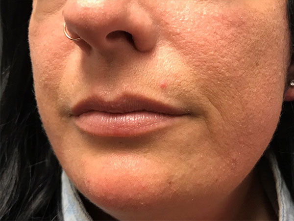 Injectables And Fillers 03