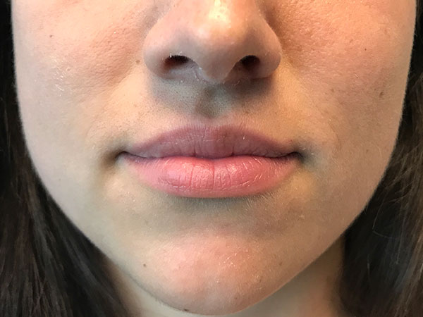 Injectables And Fillers 01