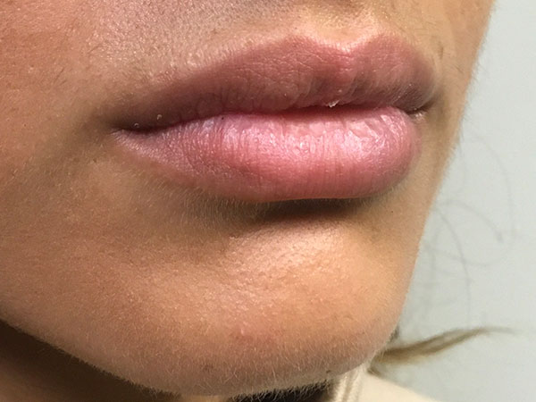 Injectables And Fillers 01