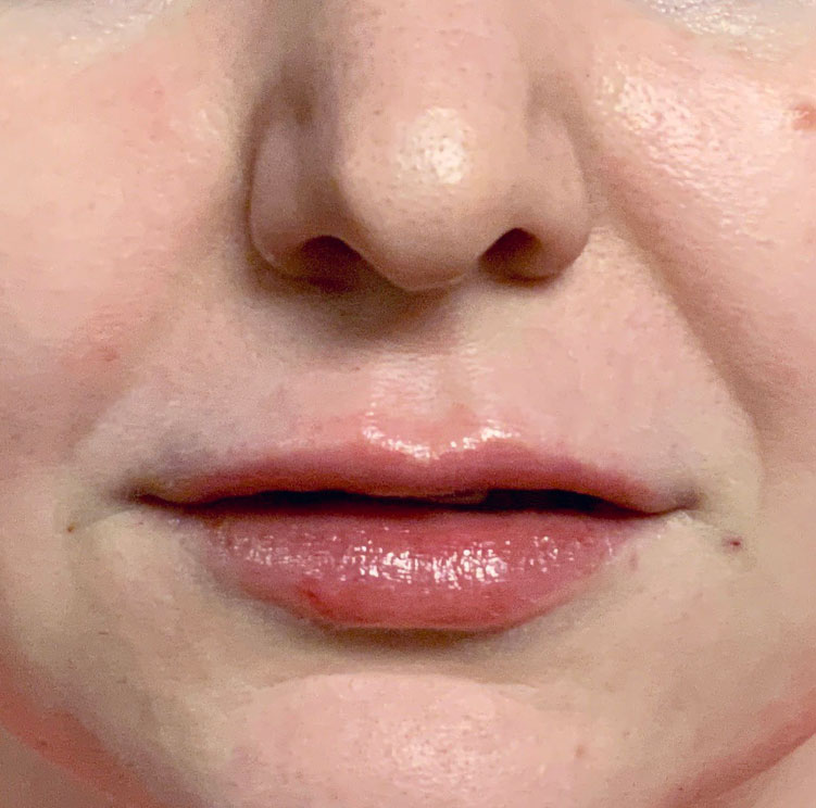 Injectables And Fillers 83