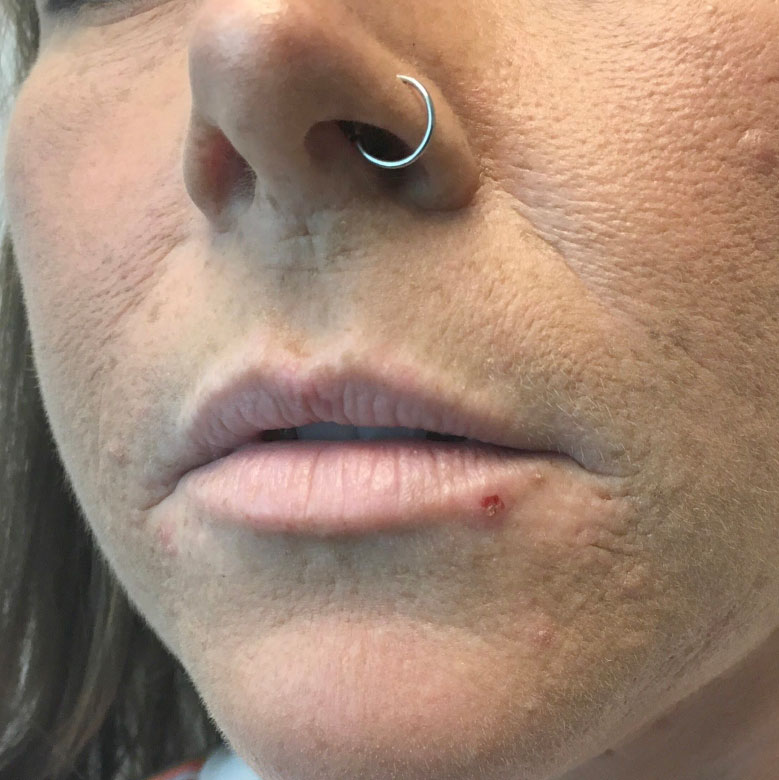 Injectables And Fillers 03