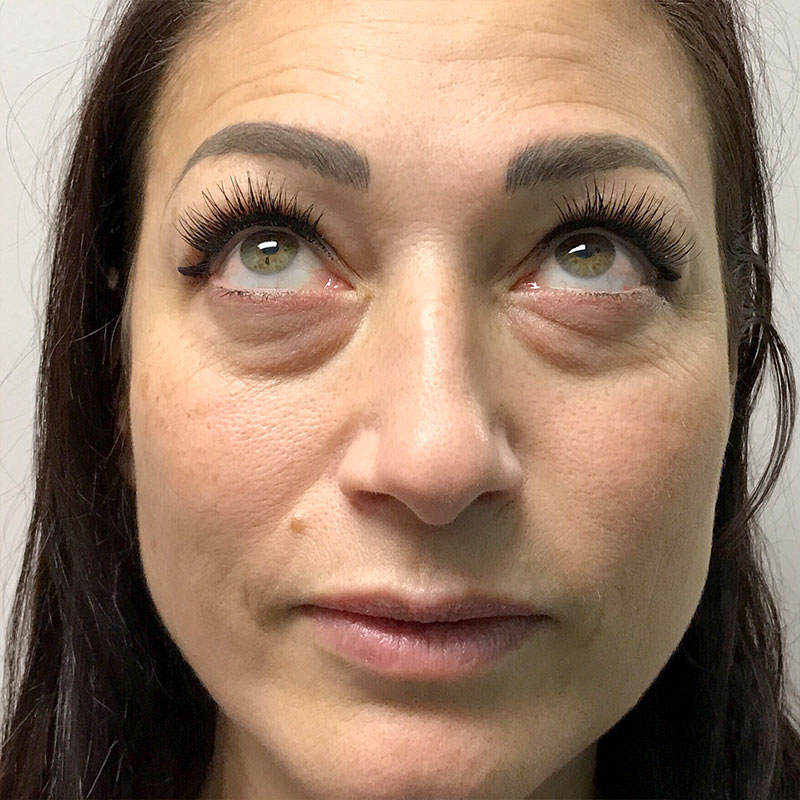 Injectables And Fillers 01