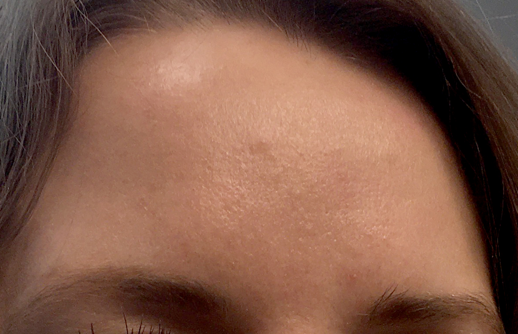 Injectables And Fillers 94