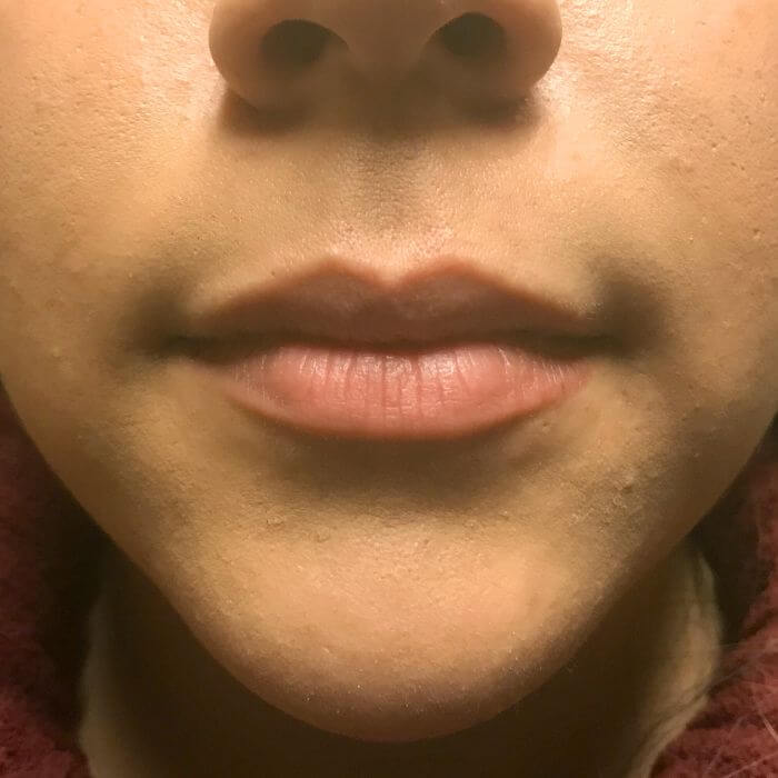 Injectables And Fillers 01