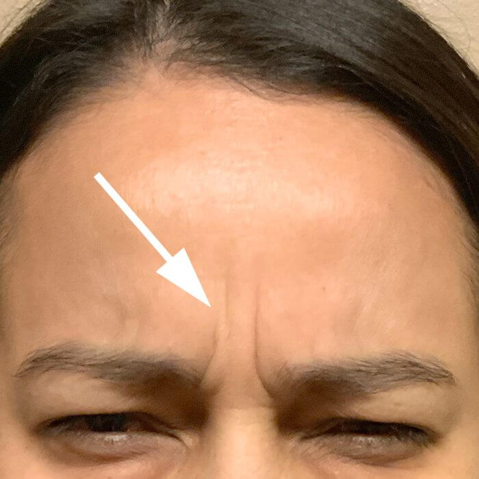 Injectables And Fillers 01