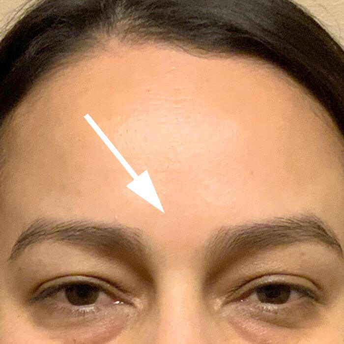 Injectables And Fillers 98