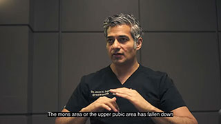 Morbidly Obese Tummy Tuck