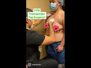 Best Seattle FTM Top Surgery