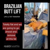 Brazilian Butt Lift Seattle