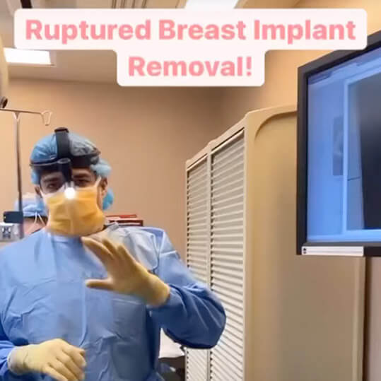 Ruptured Breast Implant Removal! En Bloc Surgery for Breast Implant Illness Patient