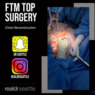 FTM Top Surgery | Chest Reconstruction by Top Seattle Plastic Surgeon