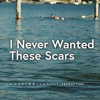 I Never Wanted These Scars | FTM Top Surgery