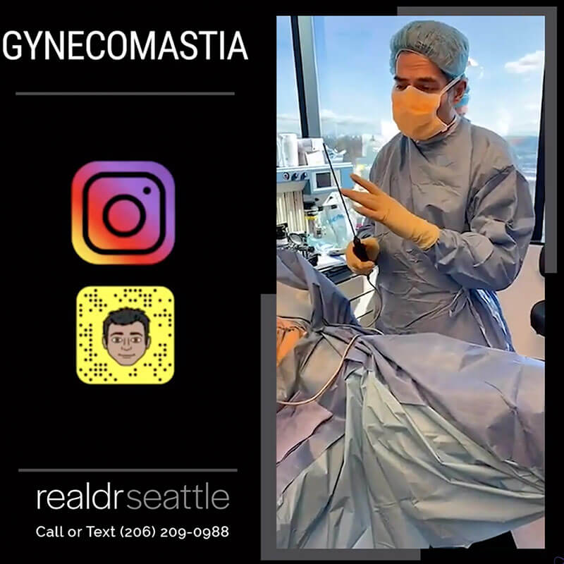 LIVE Gynecomastia Surgery No Scar Technique