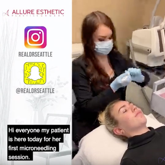 Seattle Microneedling