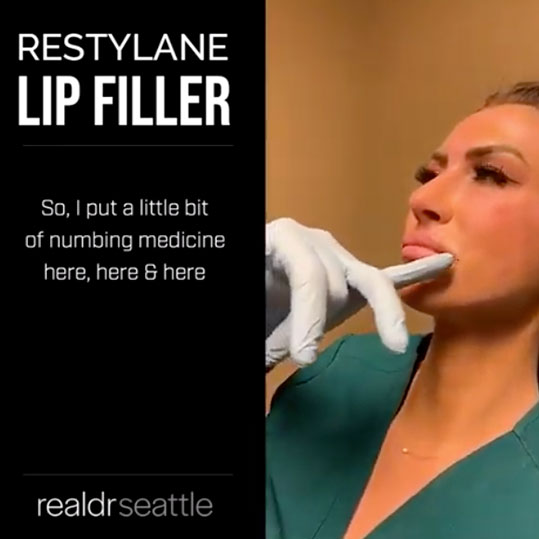 Seattle Restylane Lip Filler Injections | Real Dr. Seattle