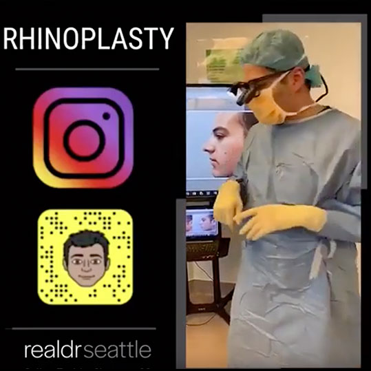 Male Rhinoplasty | Nose Job | Before and After | Seattle