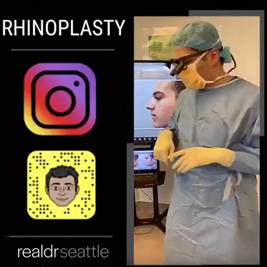 Ethnic Rhinoplasty Chicago - Nose Job