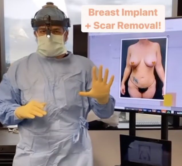 Ruptured Implant Removal for a Breast Implant Illness Patient! Enbloc Removal Full Surgery