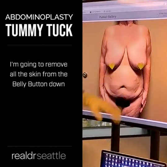 Seattle Tummy Tuck - Top Seattle Plastic Surgeon aka Dr. Seattle