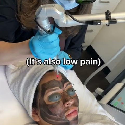 Zombie Carbon Laser Peel Seattle