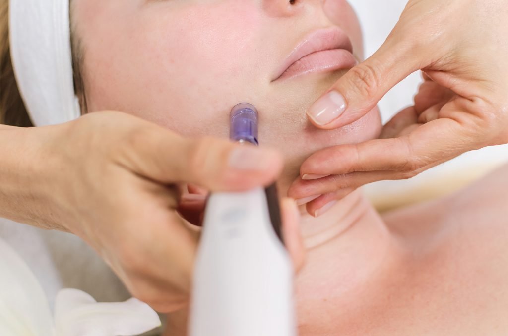 Dangers of at Home Microneedling