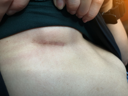 Female Breast