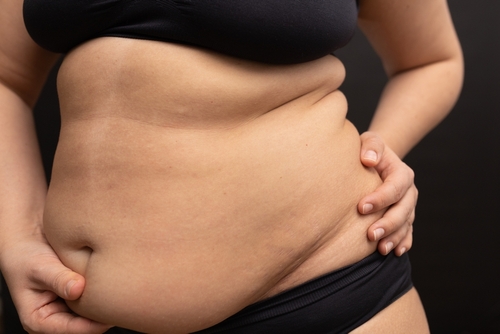 What Causes A Hanging Belly? - Blog