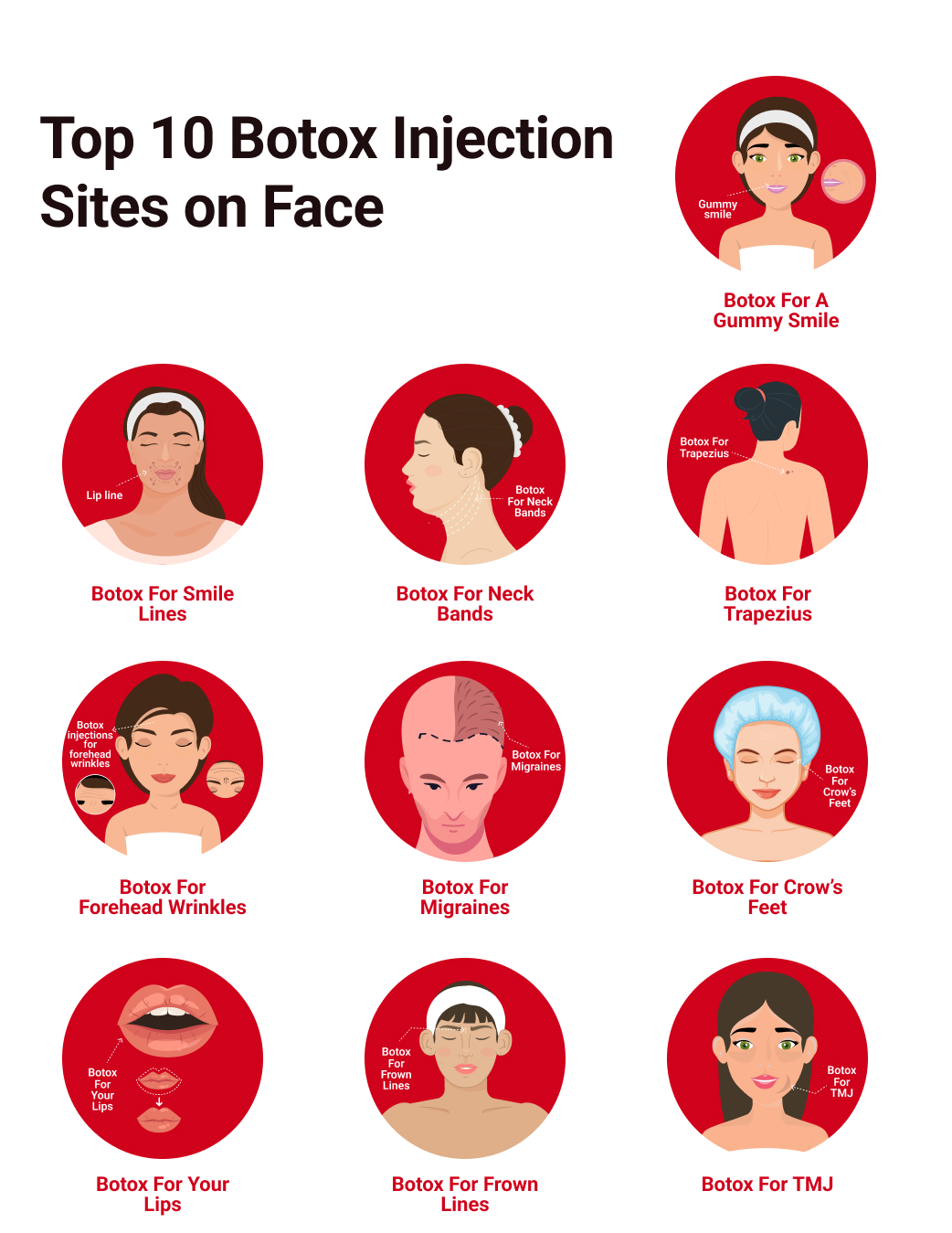 Top 10 Botox Injection Sites For The Face - Blog