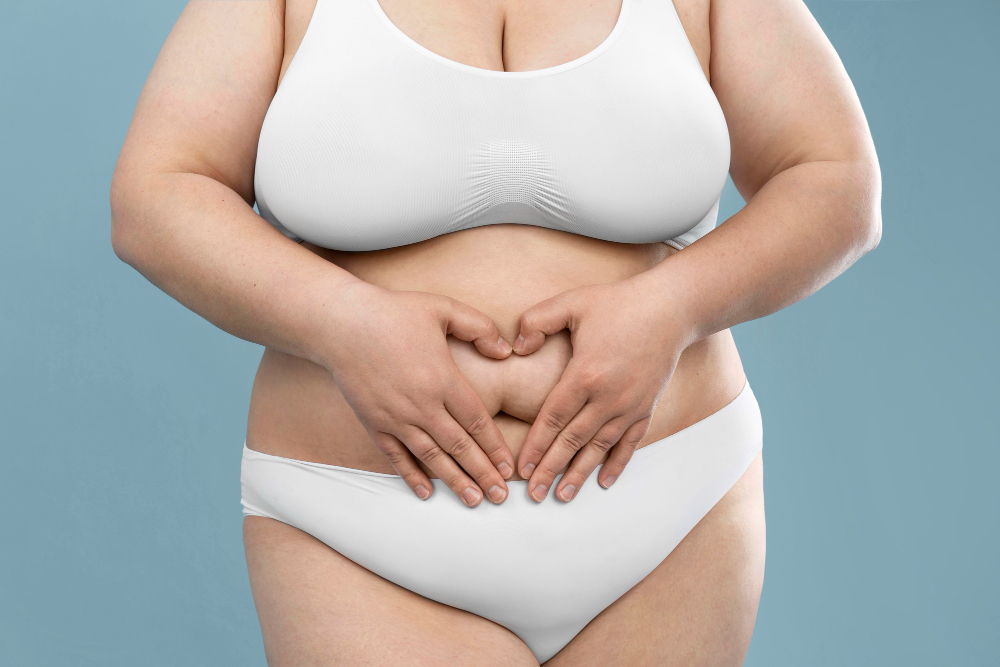 Who Is a Good Candidate for a Tummy Tuck in Seattle
