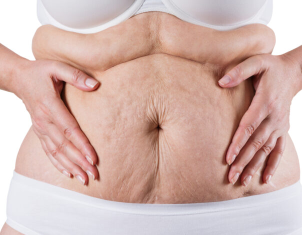 Best Plastic Surgeon for Skin Removal