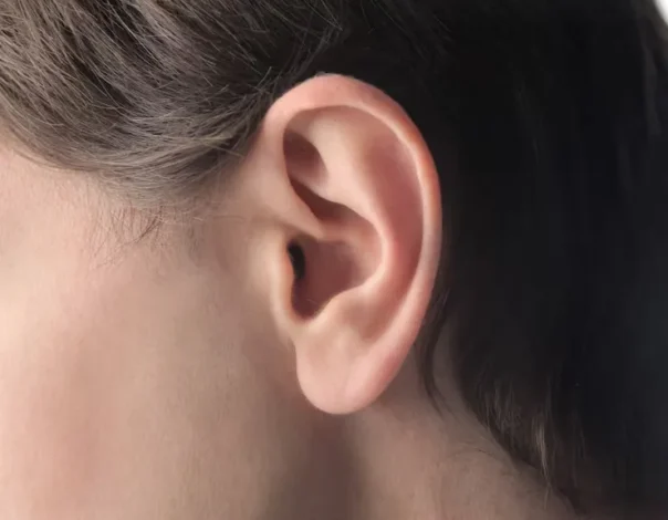 Ozempic Ears