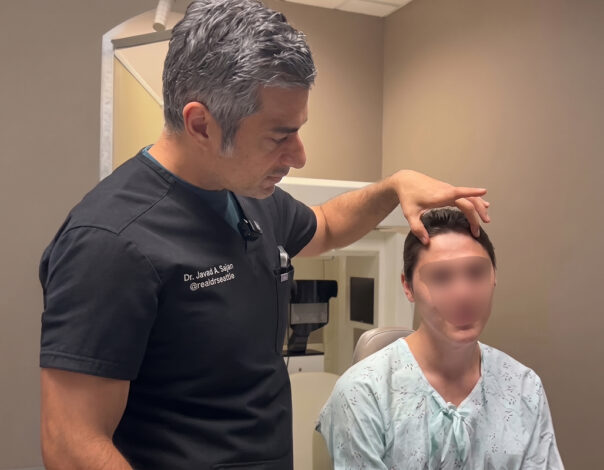 Hair Transplants Are Now Covered by Insurance