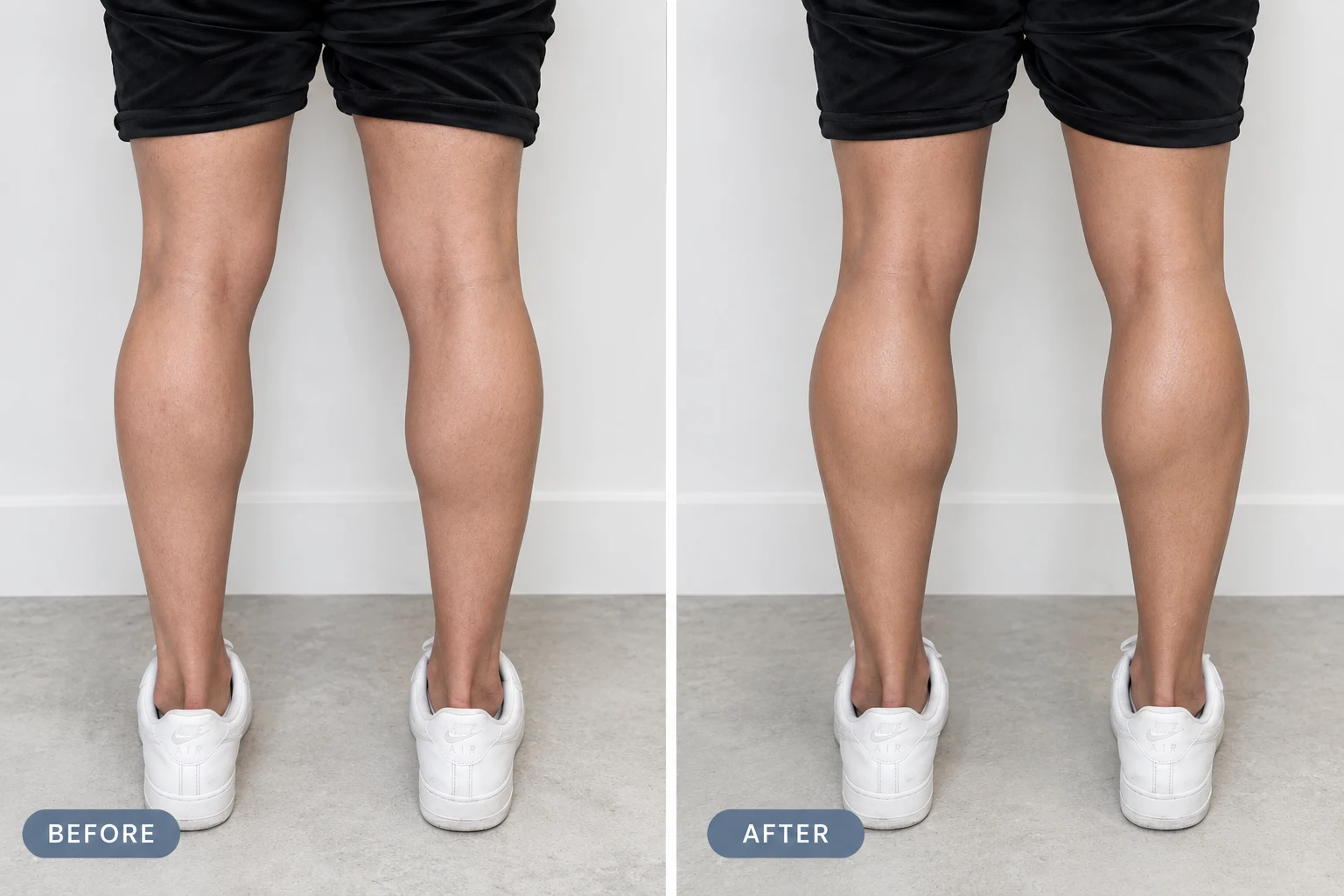 alloClae&reg; Calf Before and After