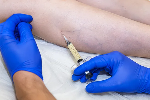 Who Is a Good Candidate for alloClae&reg; Calf Enhancement?