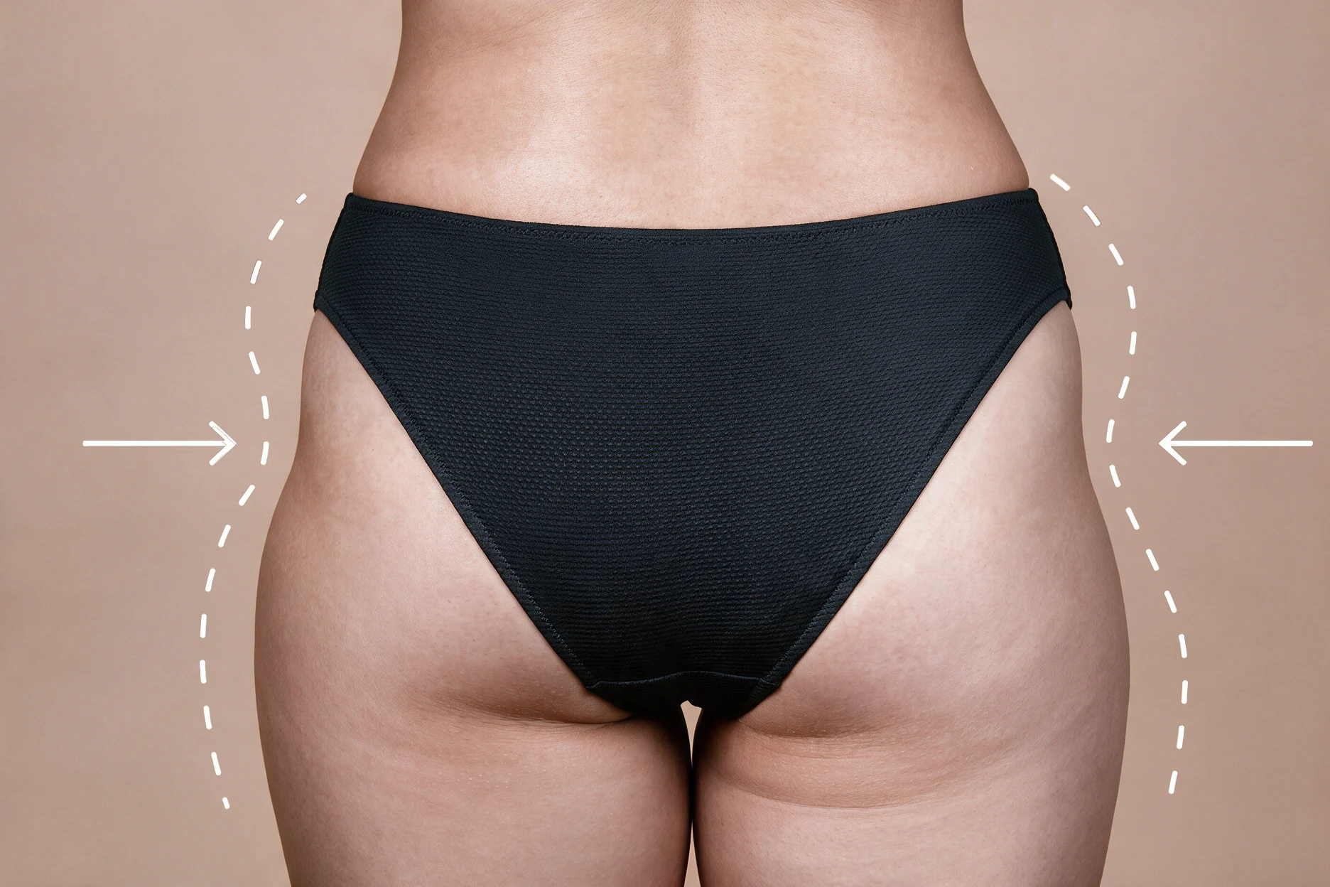 What Are Hip Dips, and Why Won't Exercise Fix Them?
